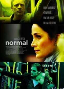 Normal – Normal